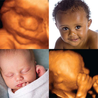materno-fetal-bebes